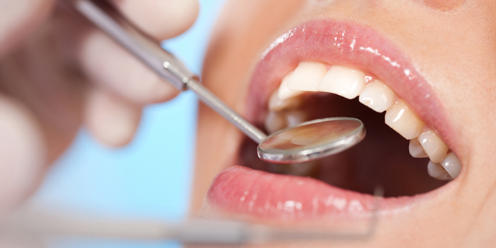 「非抜歯」のメリット&デメリット