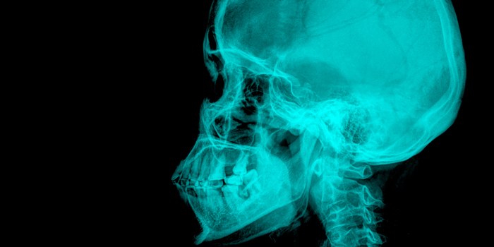 歯並びの悪化にも!? 顎偏位が全身に与える悪影響とは