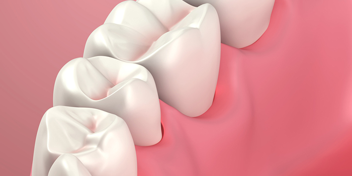 顎偏位の治療法