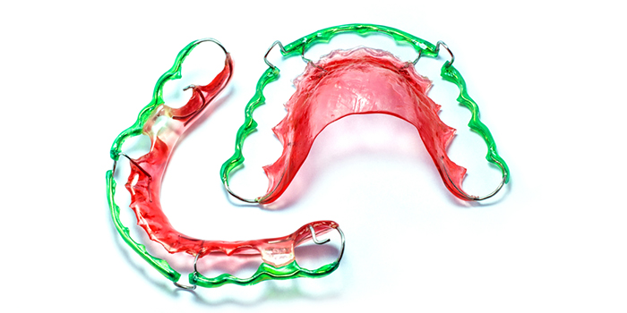 八重歯の治療法