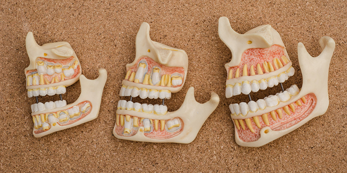 「自律神経失調症」と診断されたら疑いたい顎関節症