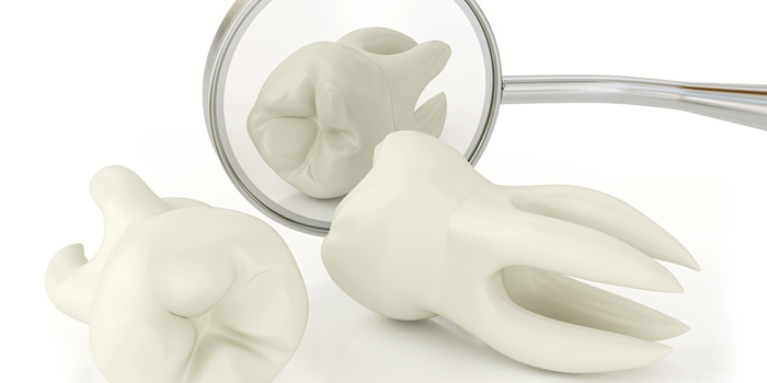 咬合神経症の悪影響