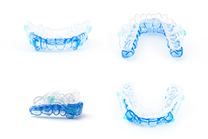 マウスピースの種類