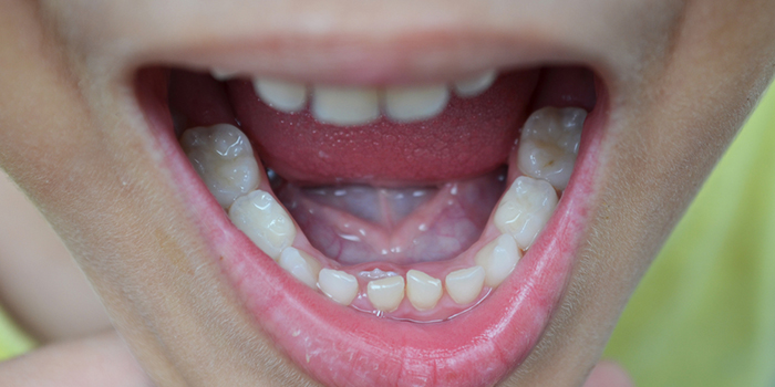 噛み合わせが悪くなる原因&健康への悪影響とは