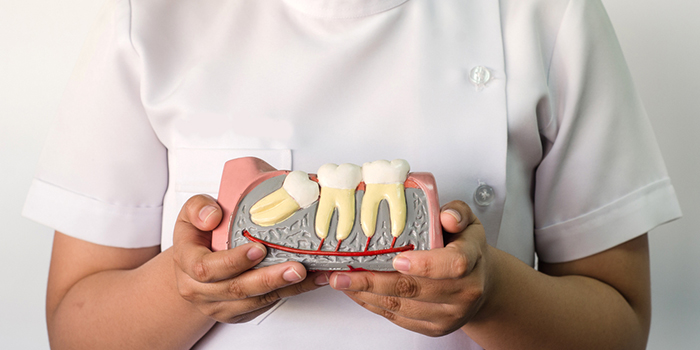 虫歯や炎症のリスクを減らす!親知らずの正しい磨き方