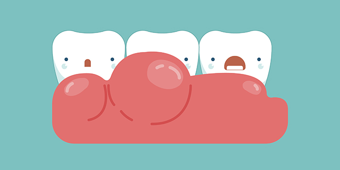 「歯茎」を知り、歯みがきを知る。歯茎に効果的なブラッシングとは