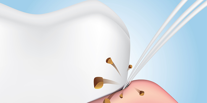 歯並びが悪い人におすすめ!「ワンタフトブラシ」とってどんなもの?