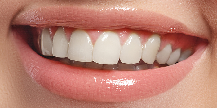 日本人の歯並びの特徴と、歯並びへの意識