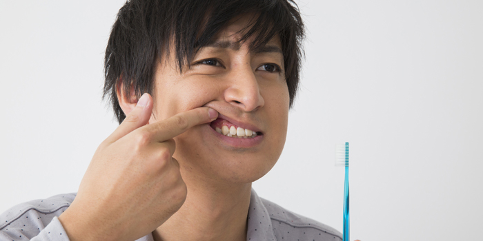 ガチャガチャ歯並び「乱杭歯」を矯正すべき理由と矯正方法