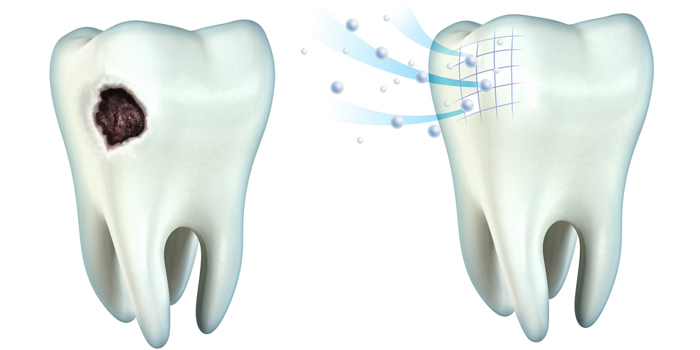 歯を強くしてくれるキシリトールガムの特徴
