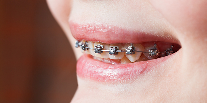 クレンチング症候群は歯と顎に悪影響を及ぼす! その症状と原因とは