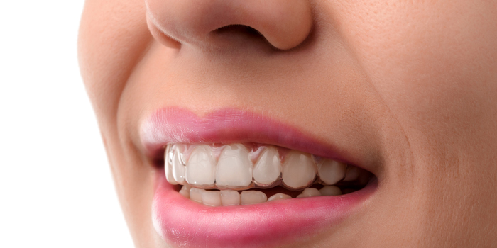 痛みを減らすことができる