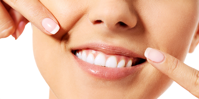 「歯列矯正」と「差し歯」歯並びを治すならどっちが良いの?