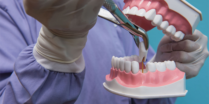 矯正で抜歯は必要? 歯列矯正治療で歯を抜くリスクと「抜かない治療」