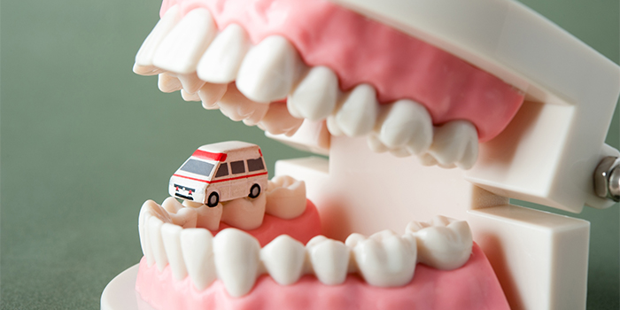 親知らず治療で覚えておきたい「ドライソケット」の原因と対処法とは?