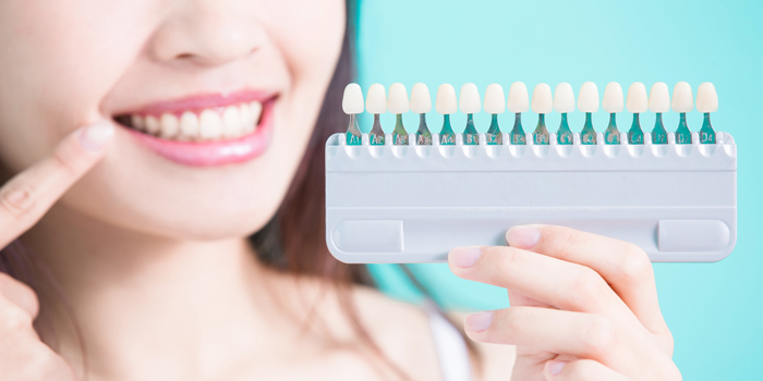 着色した歯にはホワイトニングを施そう