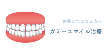 ガミースマイル