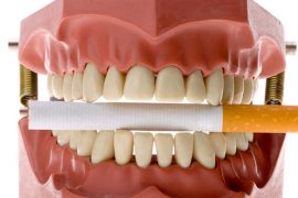 タバコの悪影響は口の中にも！喫煙と歯周病の関係とは