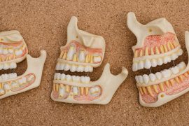 「自律神経失調症」と診断されたら疑いたい顎関節症