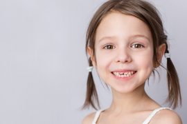 「良く噛む」人の口内は虫歯が少ない