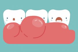 「歯茎」を知り、歯みがきを知る。歯茎に効果的なブラッシングとは