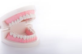 インプラントと差し歯の違いって？ 選ぶポイントとは？