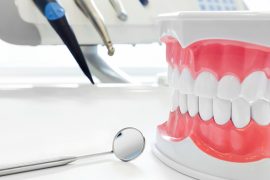 意外にたくさんあった、マウスピース矯正の種類