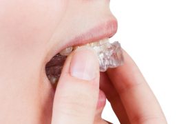 歯ぎしりをやめるには？