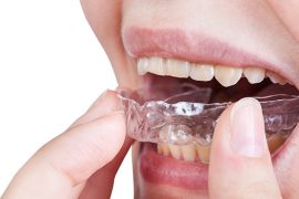 日本人は歯並びに無頓着？　外国人から見た日本人の歯並び