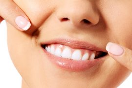 「歯列矯正」と「差し歯」歯並びを治すならどっちが良いの？