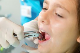 矯正で抜歯は必要？　歯列矯正治療で歯を抜くリスクと「抜かない治療」