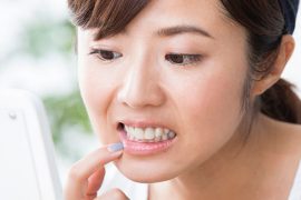 酸蝕歯はどうして起こる？　原因と予防法